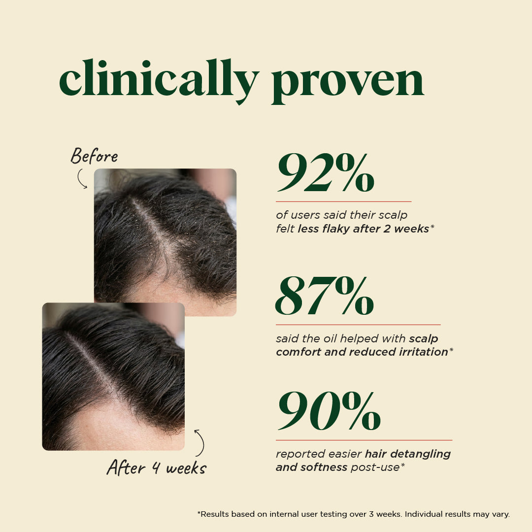 Anti-Dandruff Scalp Oil with Neem